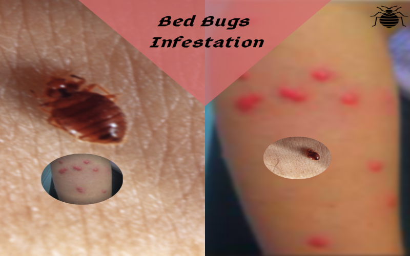 Bed bugs infestation