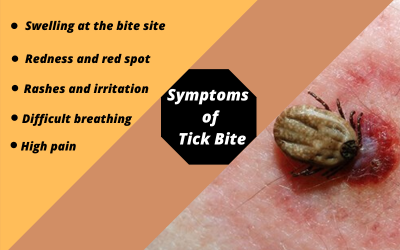 Symptoms of Ticks Bite